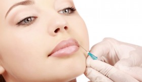 dermal-filler-treatment-780x500